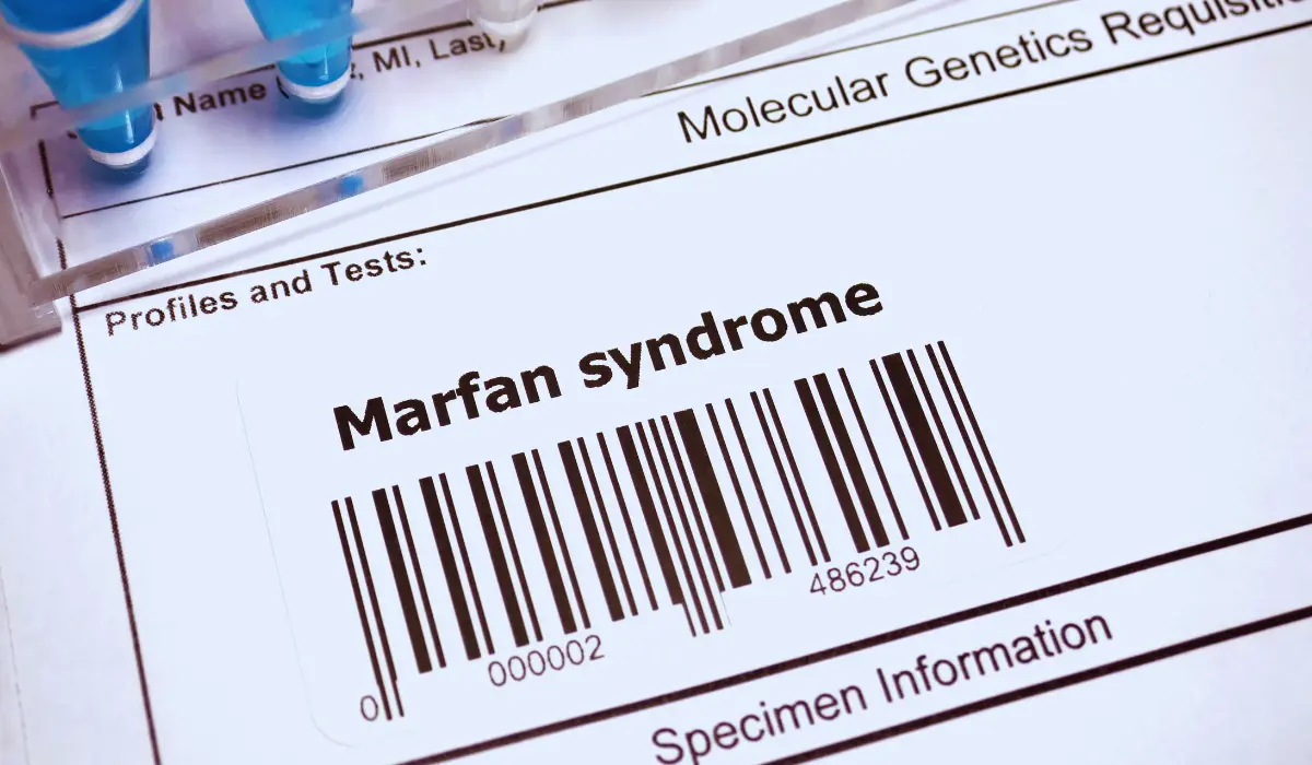 Exploring Marfan Syndrome and Its Connective Tissue Impact