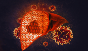 Could Blood Proteins Offer a Glimpse into the Future of Liver Cancer Detection?